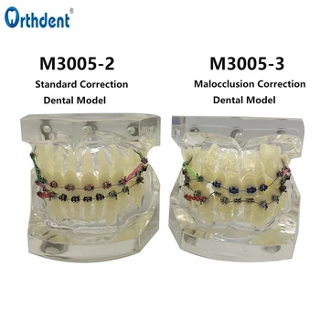 Dentare Standard De Tratament Ortodontic, Dintii Model Transparent De Predare Demonstrația Stomatologie Corectarea Malocluzii Modele